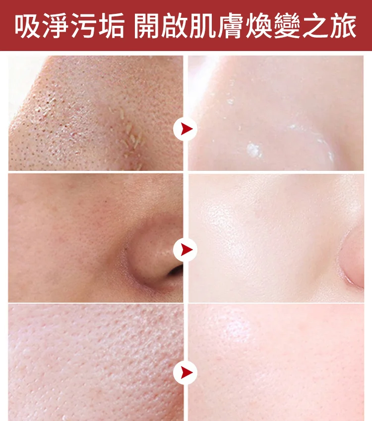 抖音爆款黑頭清潔分解棒 國民級清潔黑頭好物風靡全球累計種草300萬+ 抖音爆款黑頭清潔分解棒 國民級清潔黑頭好物風靡全球累計種草300萬+