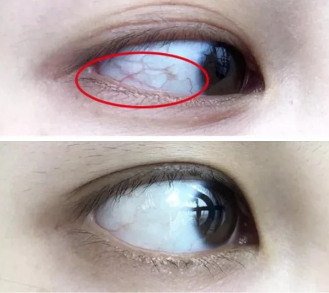 1758010168545172.jpg d8df3ac8ccd81b15d658bbcb53be5d5c.jpg